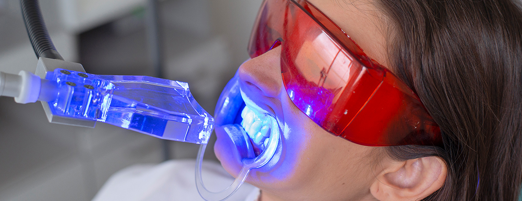 Tratamiento de blanqueamiento dental con lámpara LED en Clínica COP