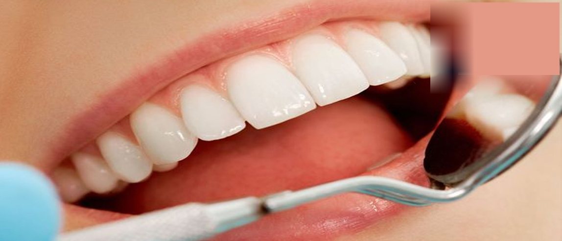Detalle de limpieza dental con espejo bucal en la Clínica Dental Antofagasta