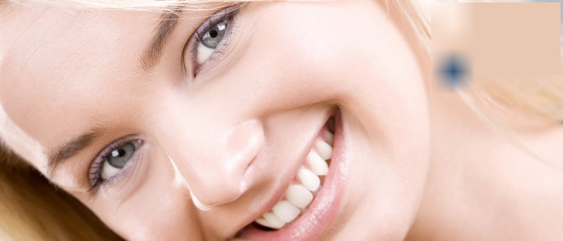 Sonrisa de paciente tras un tratamiento de estética dental