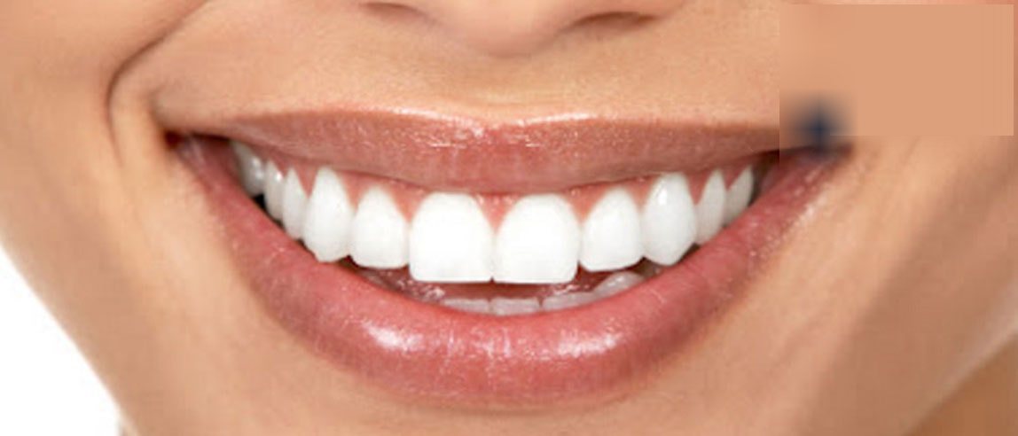 Detalle de sonrisa con dentadura pareja tras tratamiento dental