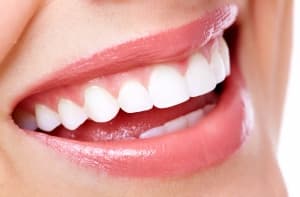 Diseño de sonrisa, planificación estética dental en Clínica Sonrilaser