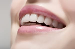 Estética dental y carillas, Clínica Sonrilaser Cúcuta