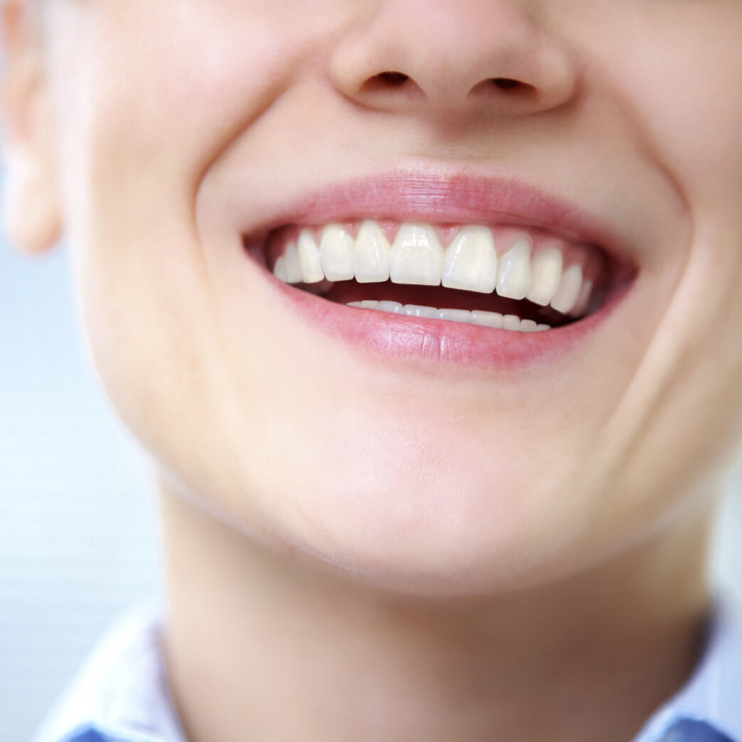 Detalhe de sorriso após procedimento de clareamento dental