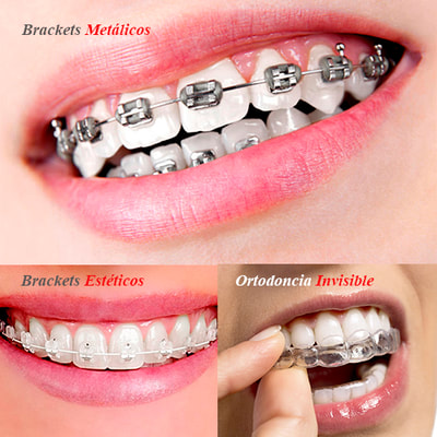 Consultorio Dental en Piura