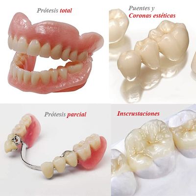 Prótesis dental total, parcial, puentes y coronas estéticas del Consultorio Dental Piura