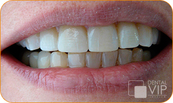 Dental VIP Service
