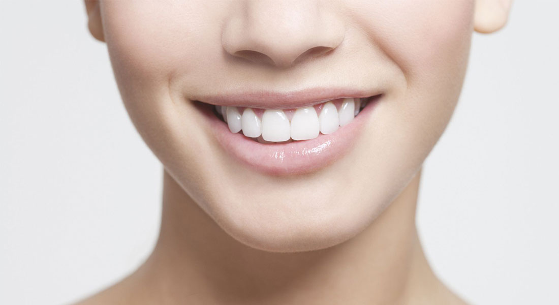 Primer plano de una sonrisa blanca y pareja, resultado de un tratamiento de estética dental