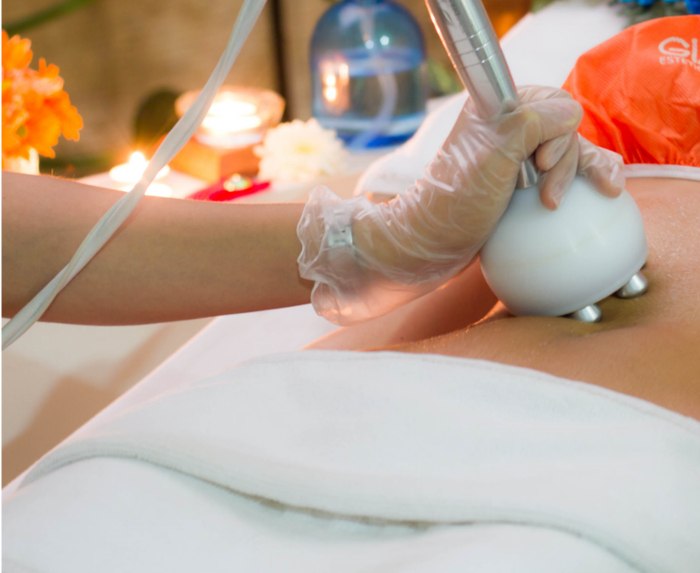 Aplicación de radiofrecuencia corporal en Giao Estética & Spa