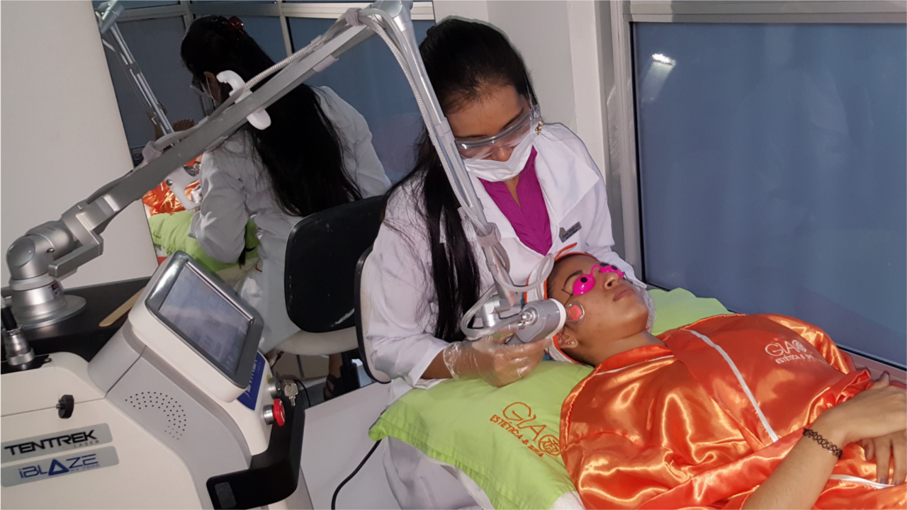 Aplicación de láser fraccionado CO2 en Giao Estética & Spa, procedimiento con protección ocular
