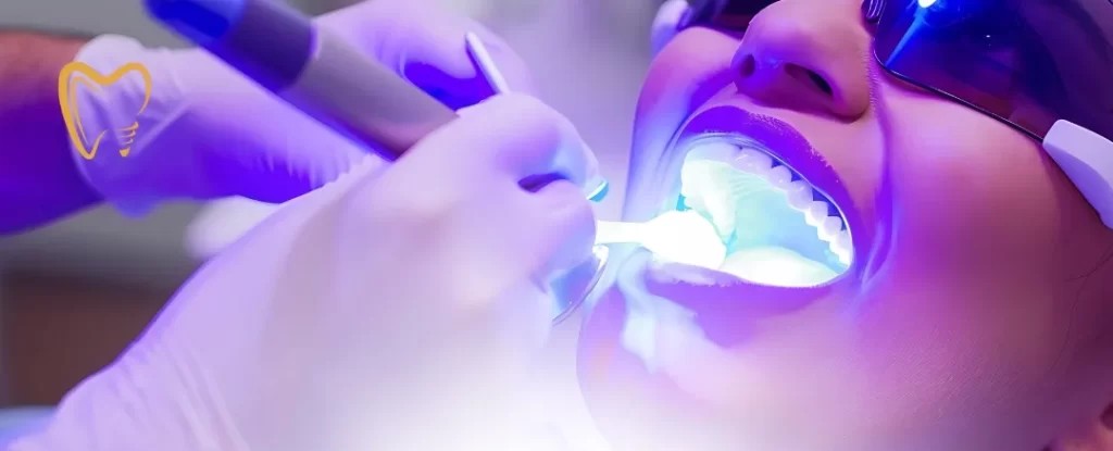 Procedimento de clareamento dental a laser sendo realizado na Orodental