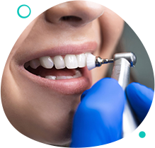 Procedimento de limpeza dental profissional na Orodental